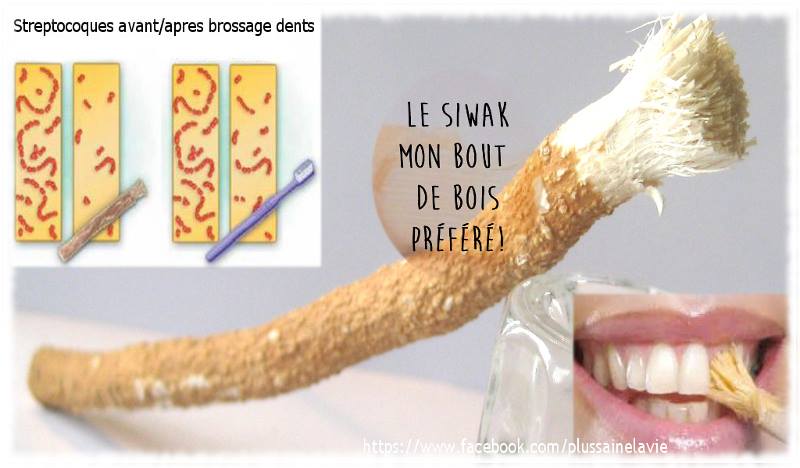 Le Siwak et ses nombreux bienfaits pour la santé bucco dentaire